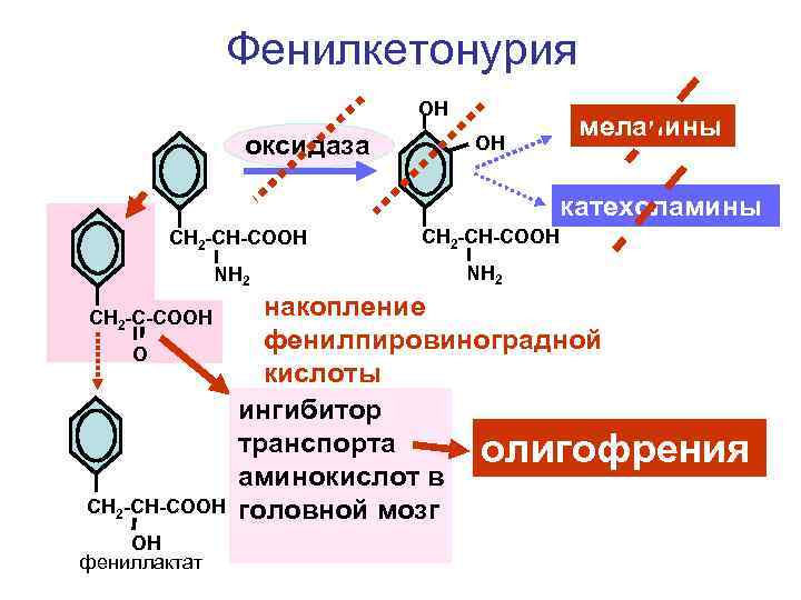 Фенилкетонурия OH оксидаза OH меланины катехоламины СН 2 -СН-СООН NH 2 СН 2 -С-СООН