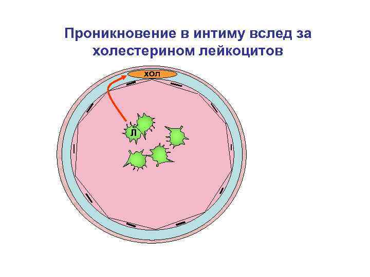 Проникновение в интиму вслед за холестерином лейкоцитов хол Л 