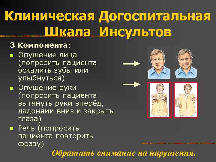 Клиническая Догоспитальная Шкала Инсультов 3 Компонента: n Опущение лица (попросить пациента оскалить зубы или