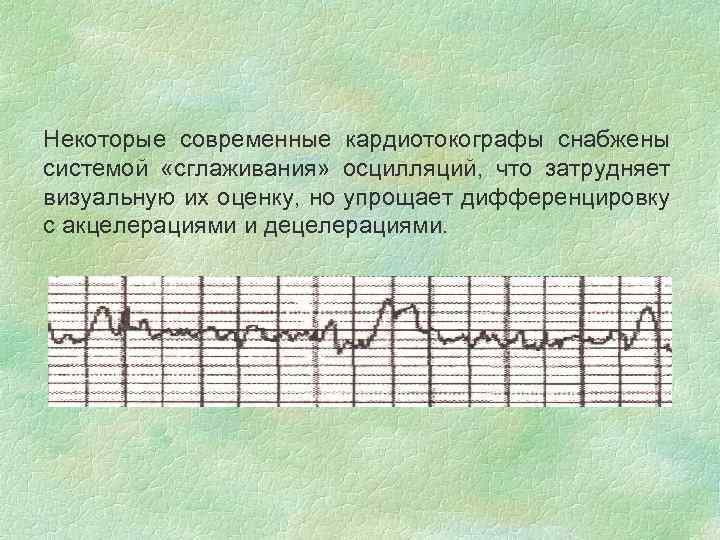 Некоторые современные кардиотокографы снабжены системой «сглаживания» осцилляций, что затрудняет визуальную их оценку, но упрощает