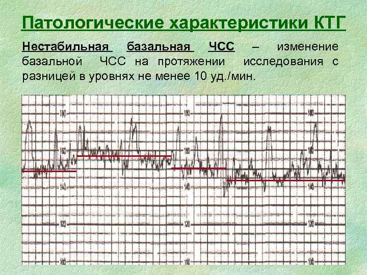 Чсс по неделям беременности