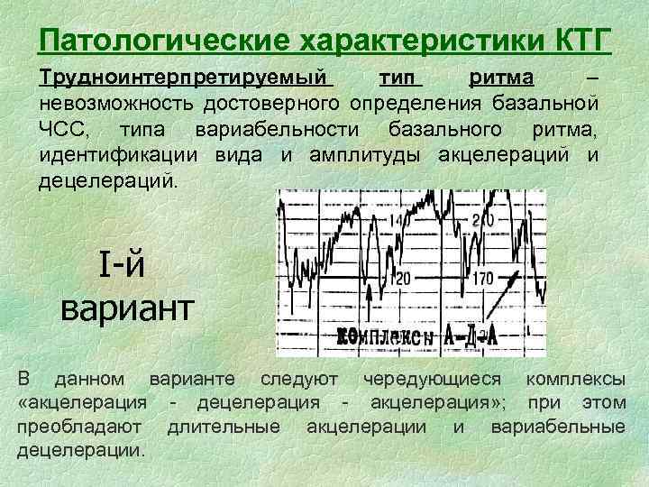 Осцилляция ктг