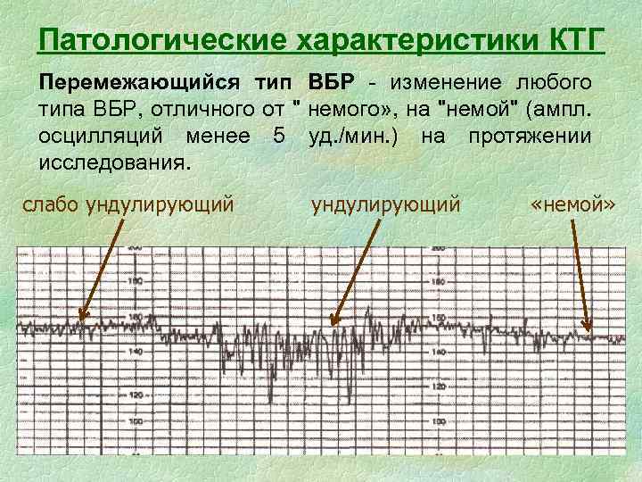 Значение ктг