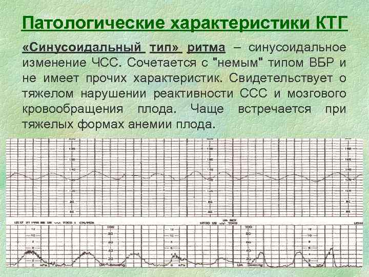 Что значит ктг