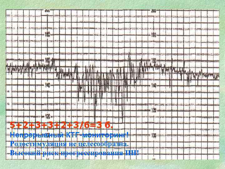 5+2+3+3+2+3/6=3 б. Непрерывный КТГ-мониторинг! Родостимуляция не целесообразна. Высокий риск прогрессирования ПН! 