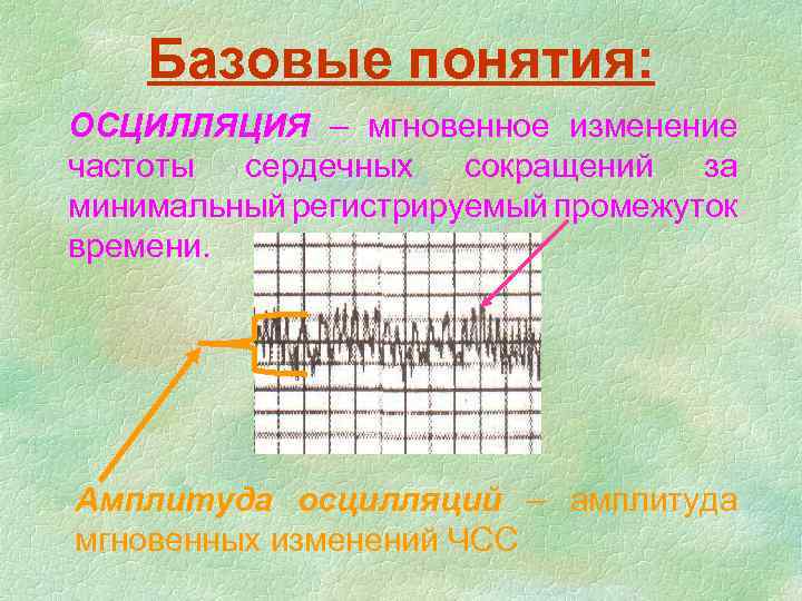 Базовые понятия: ОСЦИЛЛЯЦИЯ – мгновенное изменение частоты сердечных сокращений за минимальный регистрируемый промежуток времени.