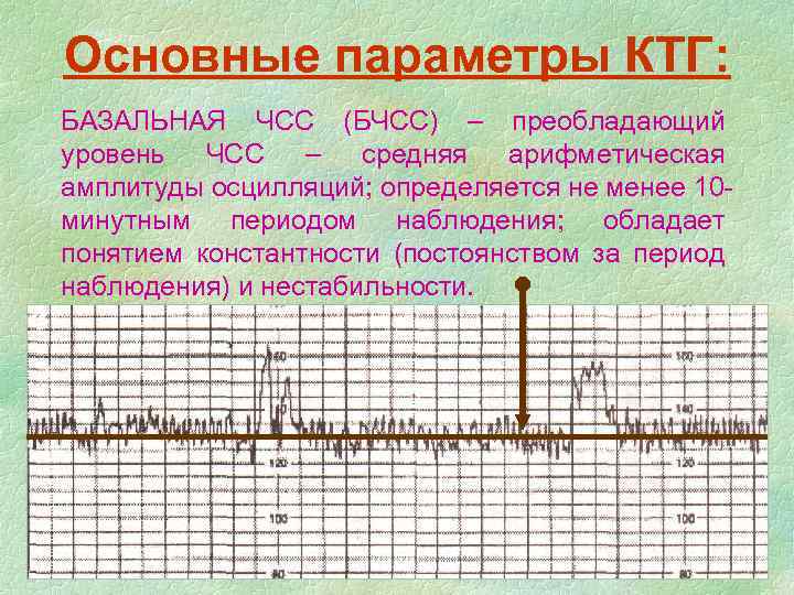 Основные параметры КТГ: БАЗАЛЬНАЯ ЧСС (БЧСС) – преобладающий уровень ЧСС – средняя арифметическая амплитуды