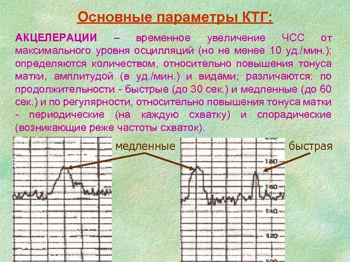 Осцилляция ктг