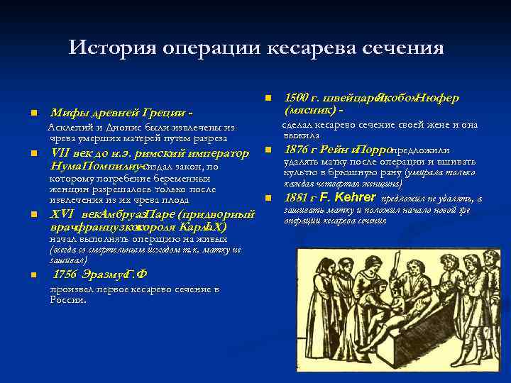 История операции кесарева сечения n n Мифы древней Греции - сделал кесарево сечение своей