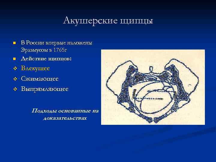 Акушерские щипцы n n v v v В России впервые наложены Эразмусом в 1765