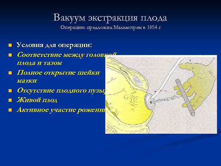 Вакуум экстракция плода презентация