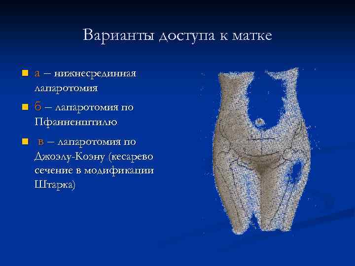 Родоразрешающие операции презентация