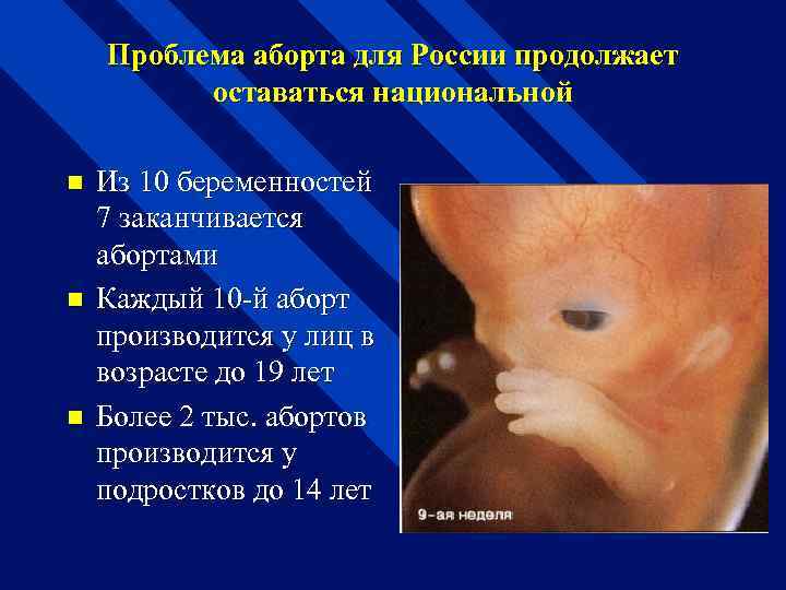 Проблема аборта для России продолжает оставаться национальной n n n Из 10 беременностей 7