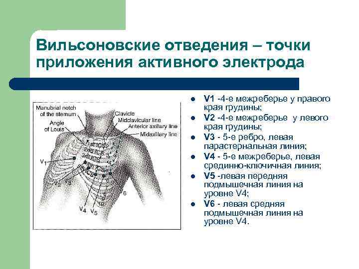 Вильсоновские отведения – точки приложения активного электрода l l l V 1 -4 -е
