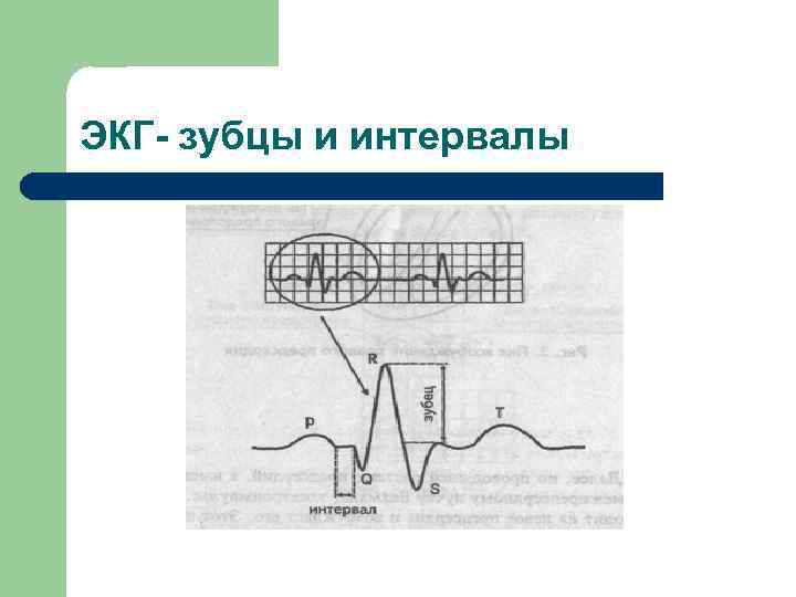 ЭКГ- зубцы и интервалы 