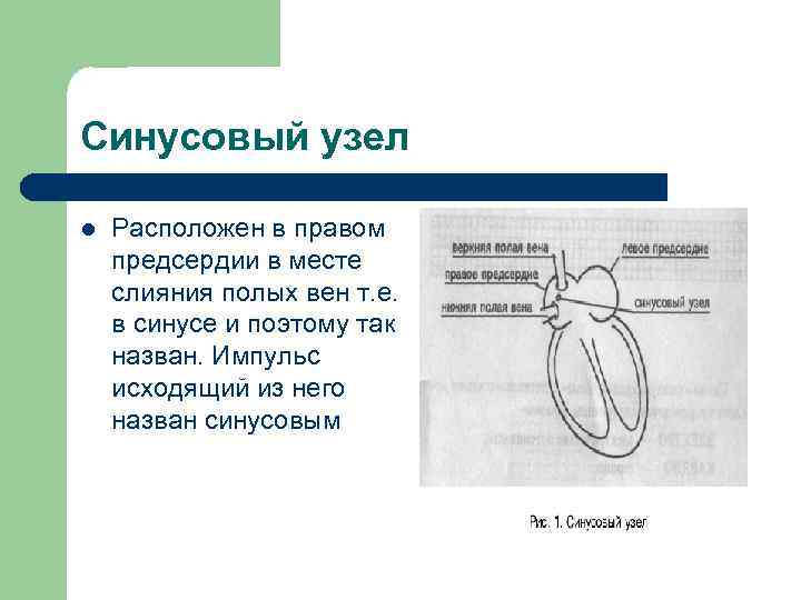 Синусовый узел l Расположен в правом предсердии в месте слияния полых вен т. е.