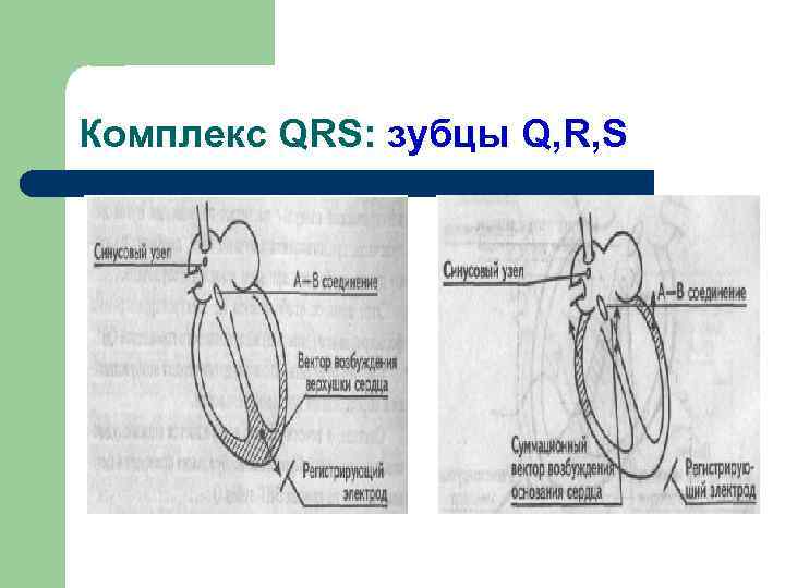 Комплекс QRS: зубцы Q, R, S 