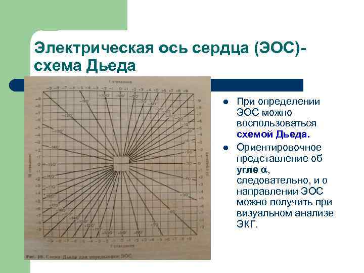 Диаграмма дьеда экг