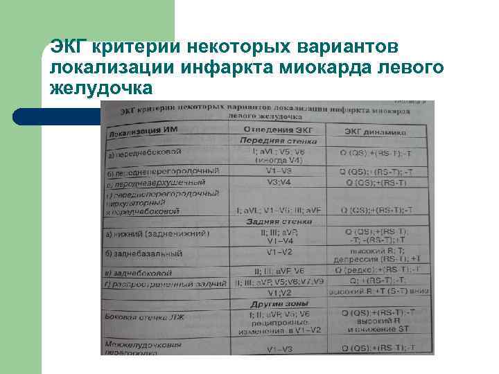 ЭКГ критерии некоторых вариантов локализации инфаркта миокарда левого желудочка 