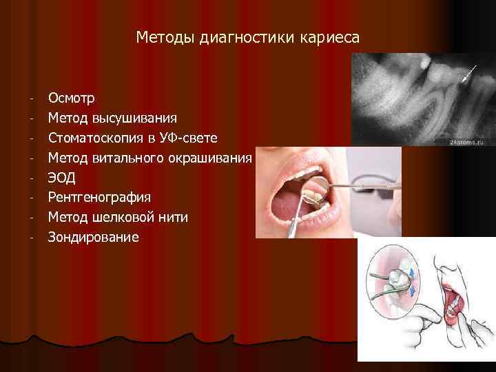 Диагностика кариеса. Методы выявления кариеса. Методы ранней диагностики кариеса. Алгоритм обследования кариозной полости.