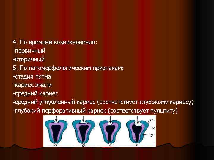 4. По времени возникновения: -первичный -вторичный 5. По патоморфологическим признакам: -стадия пятна -кариес эмали