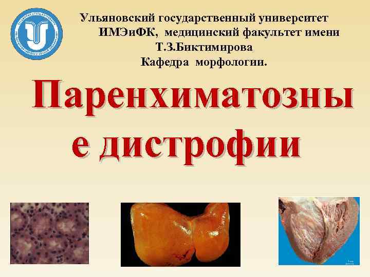 Ульяновский государственный университет ИМЭи. ФК, медицинский факультет имени Т. З. Биктимирова Кафедра морфологии. Паренхиматозны