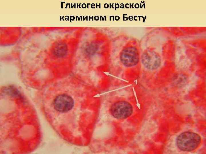Гликоген окраской кармином по Бесту 