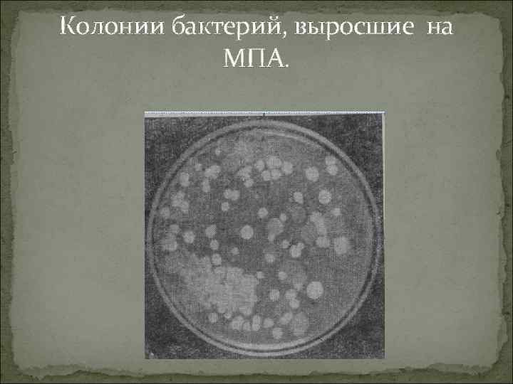 Колонии бактерий, выросшие на МПА. 