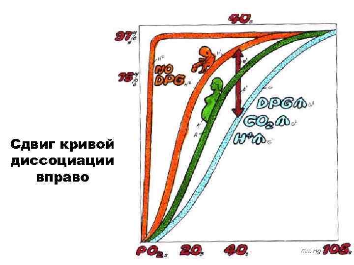 Сдвиг кривой диссоциации вправо 