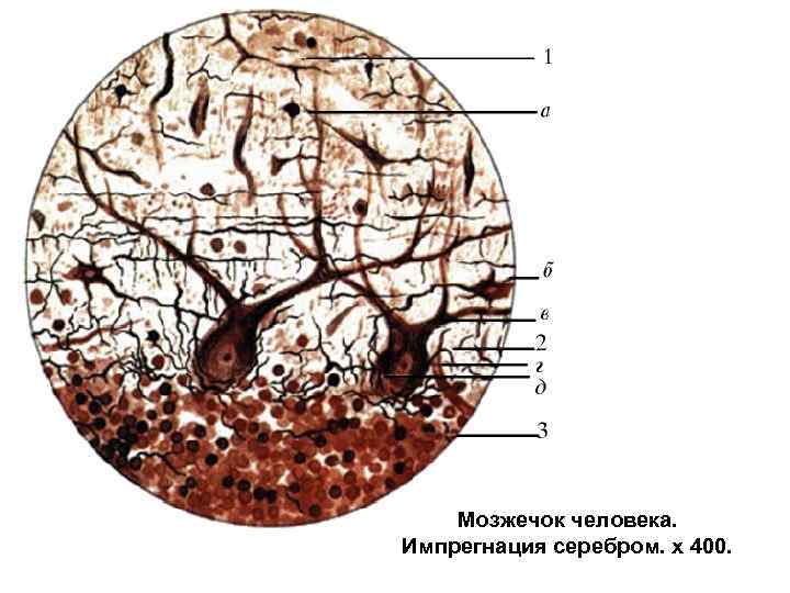 Болезнь фара гистология