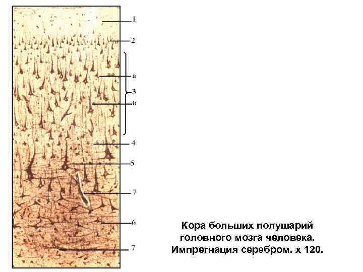 Кора больших полушарий головного мозга гистология рисунок