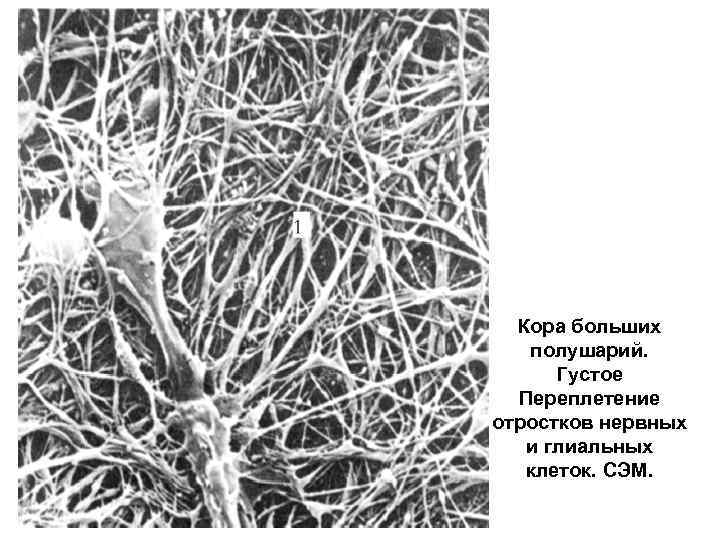 Схема коры больших полушарий