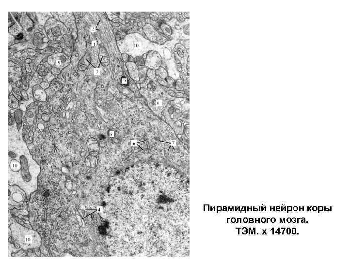 Пирамидный нейрон коры головного мозга.  ТЭМ. х 14700. 