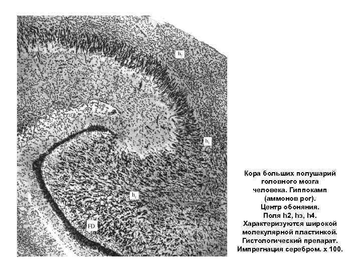 Кора больших полушарий  головного мозга человека. Гиппокамп  (аммонов рог).  Центр