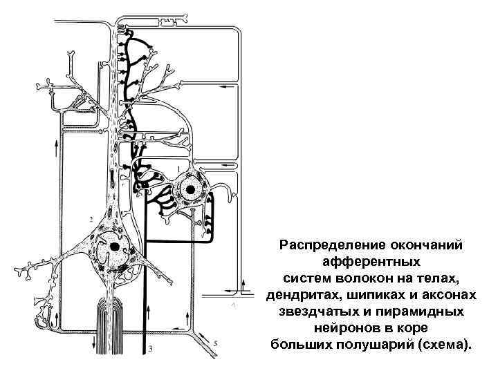 Аксонопатия моторных волокон