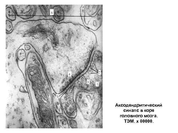 Аксодендритический синапс в коре  головного мозга. ТЭМ. x 80000. 