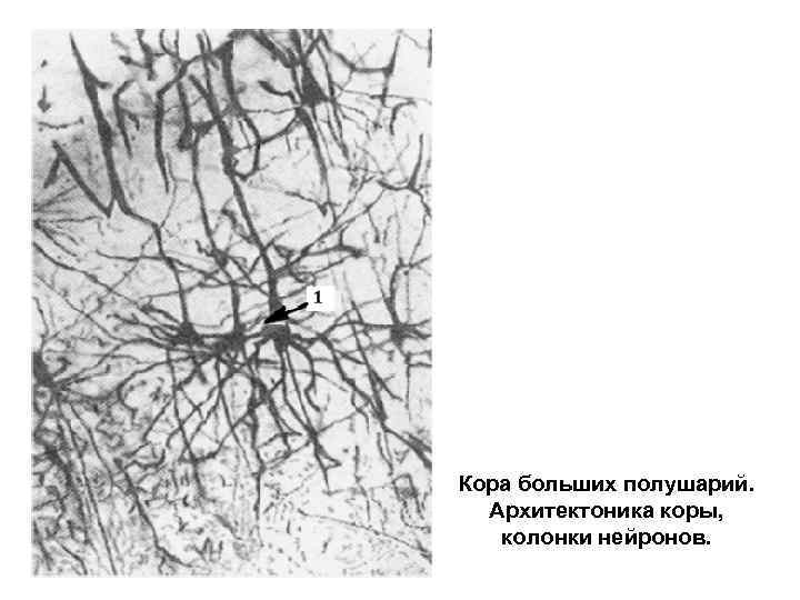 Кора больших полушарий.  Aрхитектоника коры, колонки нейронов. 