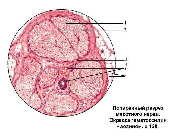 Поперечный разрез. Поперечный срез нерва препарат. Поперечный срез периферического нерва препарат. Поперечный срез мякотного нерва. Нерв в поперечном разрезе гистология.