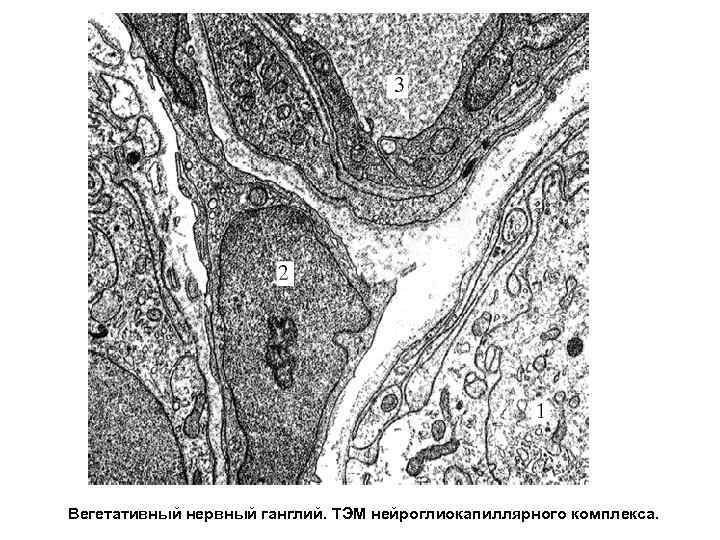 Интрамуральный ганглий гистология рисунок