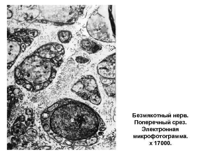 Болезнь фара гистология