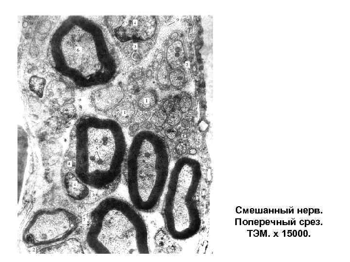 Смешанный нерв. Поперечный срез.  ТЭМ. х 15000. 