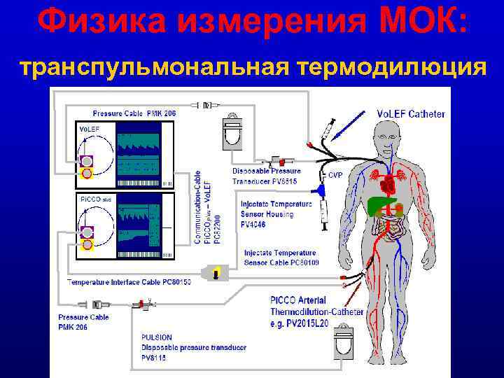 Физика измерения МОК: транспульмональная термодилюция 