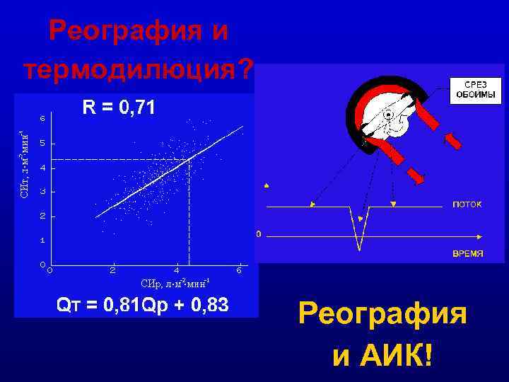 Реография и термодилюция? Реография и АИК! 