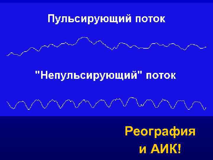 Реография и АИК! 