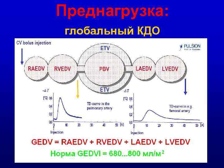 Преднагрузка: глобальный КДО 