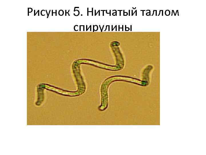 Рисунок 5. Нитчатый таллом спирулины 