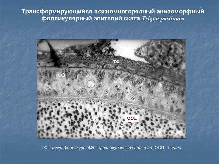 Трансформирующийся ложномногорядный анизоморфный фолликулярный эпителий ската Trigon pastinaca ТФ ФЭ ООЦ ТФ – тека