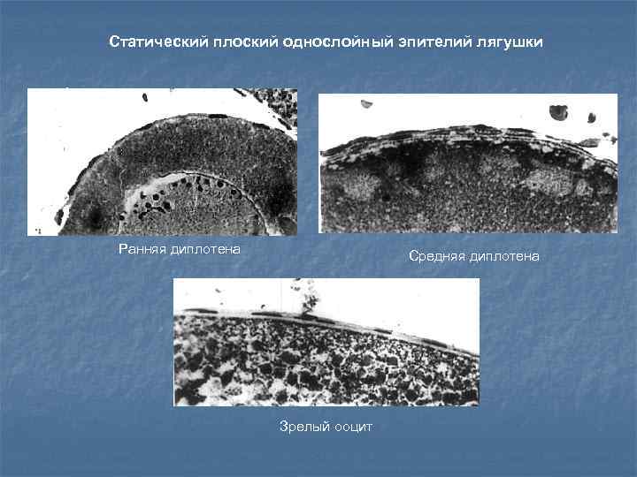 Статический плоский однослойный эпителий лягушки 1 2 Ранняя диплотена Средняя диплотена 3 Зрелый ооцит
