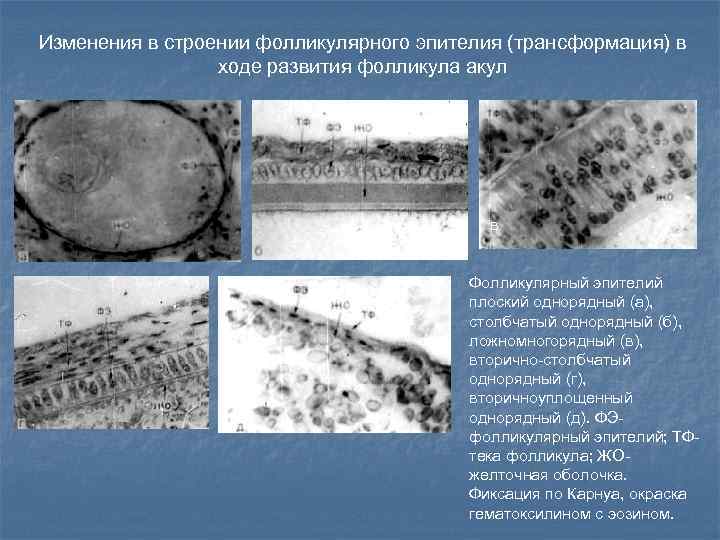 Изменения в строении фолликулярного эпителия (трансформация) в ходе развития фолликула акул в Фолликулярный эпителий