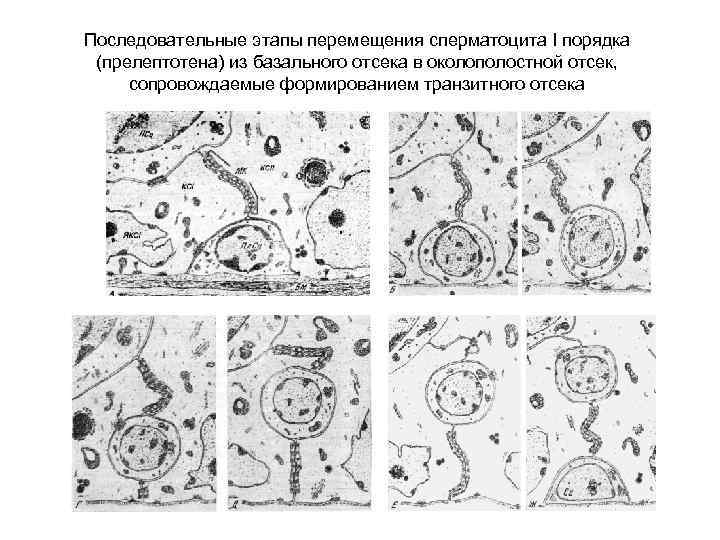 Последовательные этапы перемещения сперматоцита I порядка (прелептотена) из базального отсека в околополостной отсек, сопровождаемые